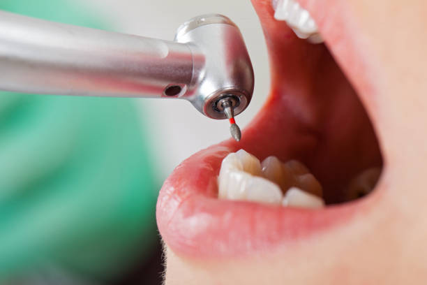 Reliable RI Emergency Dentist Solutions